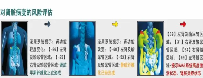鹰眼人体电阻抗测评分析仪 鹰眼人体电阻抗测评分析仪