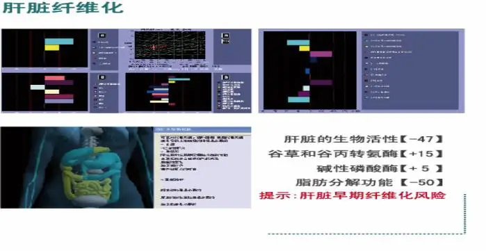 鹰眼人体电阻抗测评分析仪 鹰眼人体电阻抗测评分析仪