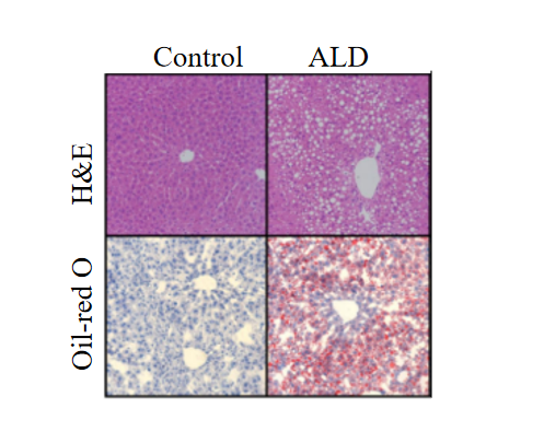 动物模型 | 酒精相关性肝病模型构建指南