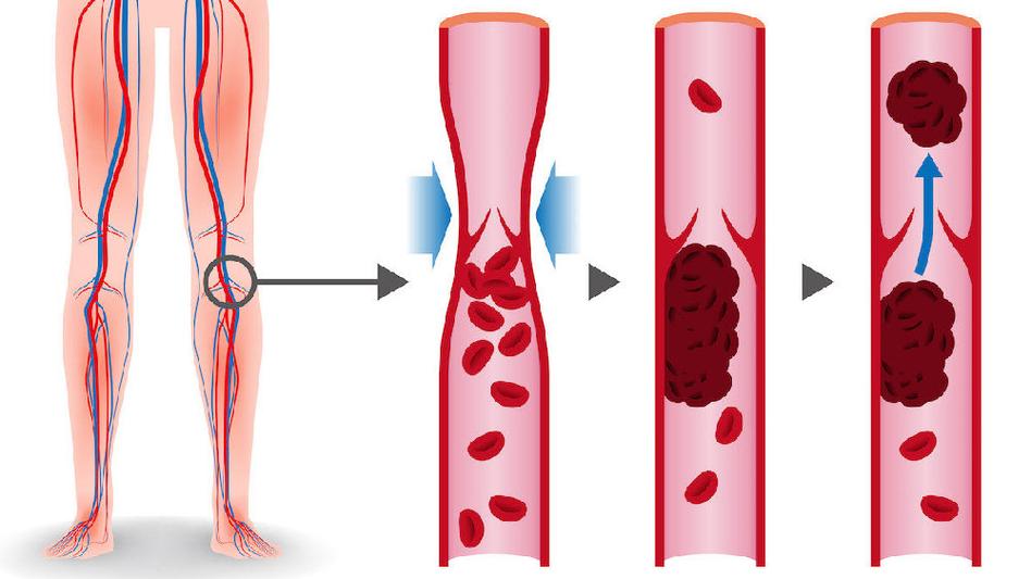 【健康科普】养血管 =···