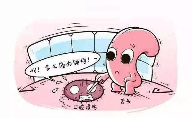康盈科普 | 反复口腔溃疡?警惕这种“会伪装的疾病”!(图3) 康盈科普 | 反复口腔溃疡?警惕这种“会伪装的疾病”!(图3)