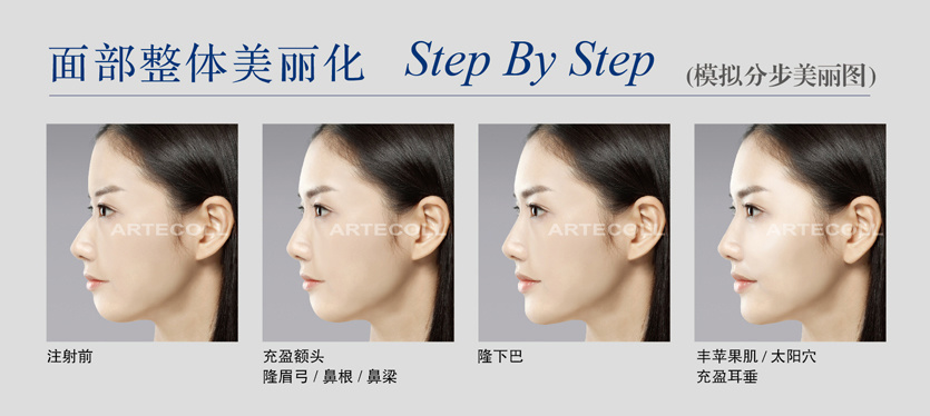 虞美人艺术面雕——爱贝芙